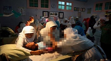 Hủ tục cắt cửa mình bé gái ở Indonesia