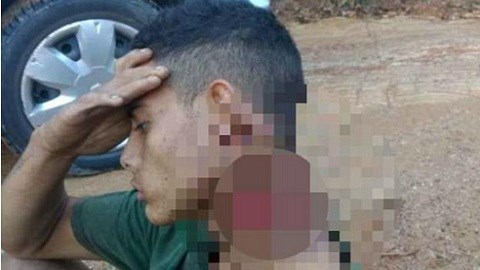 Brazil: Bị chém gần lìa cổ, chàng trai giữ đầu khỏi lệch cả đêm chờ cứu hộ
