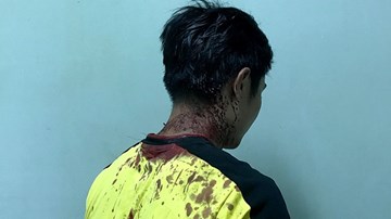 TP.HCM: 20 thanh niên đập phá phòng trọ, đánh bị thương 1 CSGT