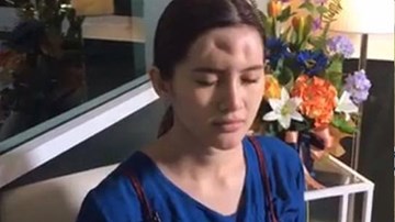 Dân tình choáng nặng vì trán kỳ dị của gái đẹp Nhật Bản