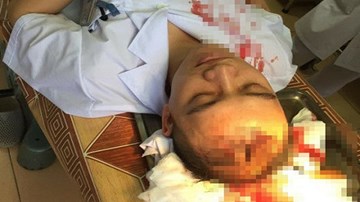 Hành hung dã man bác sĩ: Thực trạng đáng báo động!
