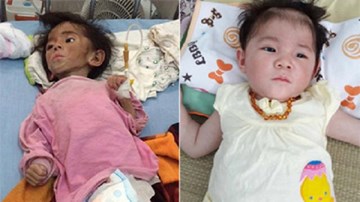 Tin hot 24h: Bé gái Lào Cai 'da bọc xương' gây bất ngờ với hình ảnh mới