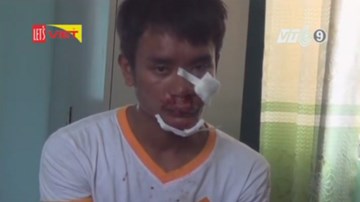 Bị giật điện thoại, cô gái truy đuổi, đạp cướp ngã sưng mặt