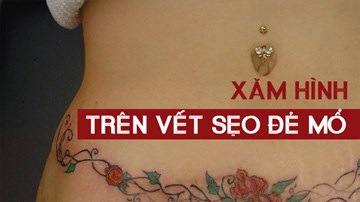 Độc đáo nghệ thuật xăm hình trên vết sẹo đẻ mổ