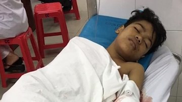 Thiếu niên 15 tuổi mất cánh tay khi đang làm việc