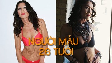 Hành trình vượt lên số phận của người mẫu 26 tuổi nhăn nheo như bà già