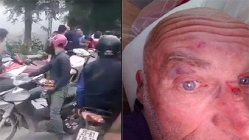 Công an điều tra vụ du khách Hà Lan bị hành hung ở Sa Pa