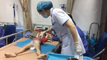Điều trị miễn phí cho trẻ mắc sùi mào gà phát hiện từ ngày 18/7