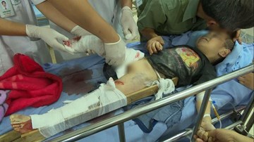 Lời kể ám ảnh của bà nội bé trai bị mất đôi chân do sạt lở đá ở Sơn La