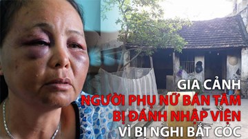 Gia cảnh người phụ nữ bán tăm bị đánh nhập viện vì bị nghi bắt cóc