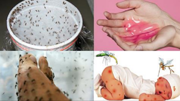 Những cách thức đơn giản để không bị muỗi đốt
