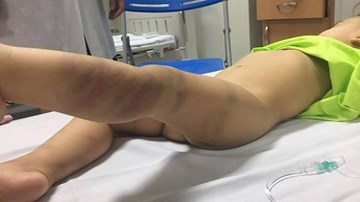 Lộ diện người phụ nữ “bí ẩn” bỏ lại bé trai 14 tháng tuổi bị bạo hành