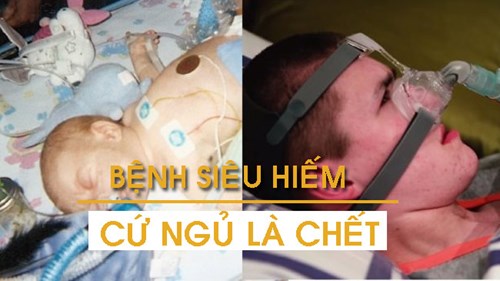 Câu chuyện của chàng trai mắc 'lời nguyền' cứ ngủ là chết!