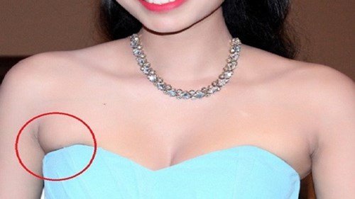 Bài tập giúp loại bỏ mỡ vùng dưới cánh tay