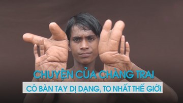 Chàng trai hiền lành có bàn tay của quỷ