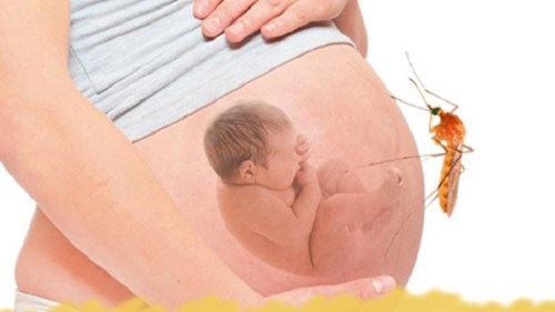 Nguy cơ biến chứng khi phụ nữ mang thai bị sốt xuất huyết