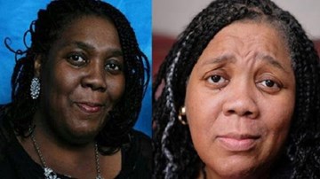 Uống thuốc chữa ung thư, một phụ nữ gốc Phi 'đổi màu' thành da trắng