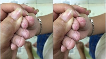 Bé trai 5 tuổi bị sốc tâm lý vì bị ép học chương trình lớp 1