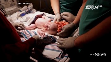 Bác sĩ đang đỡ đẻ cũng trở dạ sinh con