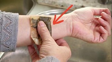 Túi trà đã qua sử dụng: Phương pháp chữa bệnh thần kỳ