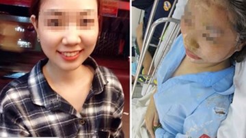 Mù mắt, cụt mũi vì axit, cuộc đời bế tắc sau 