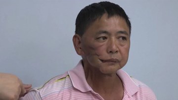 Nhiều người bị ung thư miệng do nhai trầu