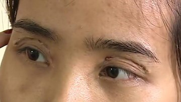 Cảnh báo chị em 