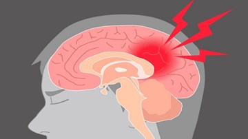 Điều gì xảy ra với não bộ khi bạn bị đập vào đầu?