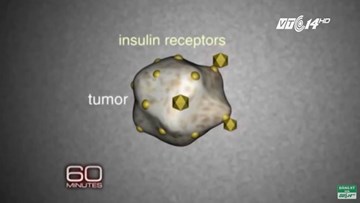 Cảnh báo: Bệnh ung thư có thể xuất phát từ đường