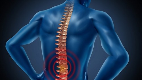 Liệu pháp gây tê màng cứng giúp người bị liệt đi lại được