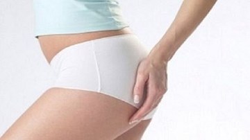 Phẫu thuật độn mông, nhiều phụ nữ gặp biến chứng kinh hoàng