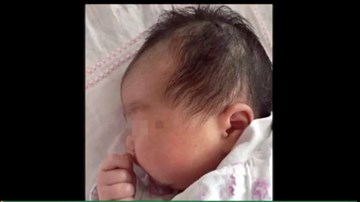 Kỳ lạ bé vừa chào đời đã 18 tuổi