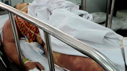 Thầy cúng chữa bệnh bằng roi dâu tằm, 2 chị em nguy kịch