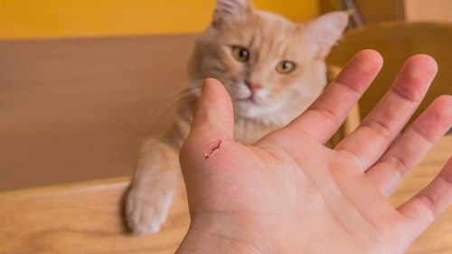 Bé gái 3 tuổi suýt chết chỉ vì một vết mèo cào