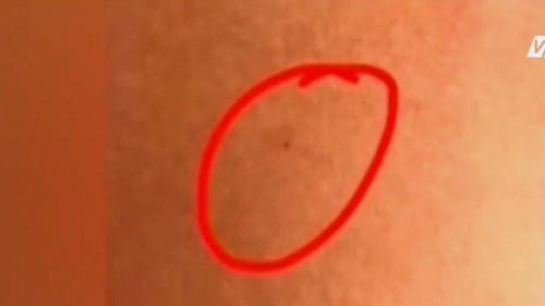 Trường mẫu giáo bị tố dùng kim đâm trẻ, cho trẻ uống thuốc lạ