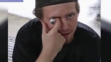 Người đàn ông có biệt tài móc mắt lồi ra ngoài