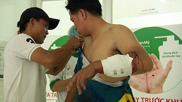 Từ chuyện cẩu xe đến chém người