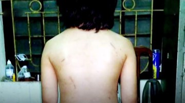 Những vụ bạo hành trẻ em gây chấn động dư luận gần đây