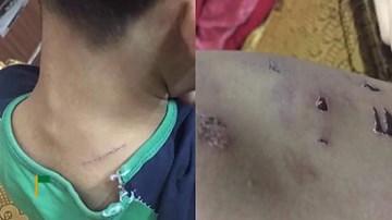 Dùng dây điện đánh con 9 tuổi tím người, người bố nói gì?