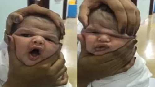 Ba y tá hành hạ trẻ sơ sinh khiến cả thế giới phẫn nộ