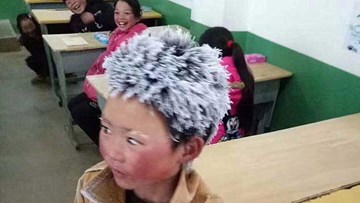 Đi bộ tới trường, cậu bé bị đóng băng toàn bộ tóc