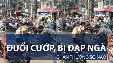 Đuổi cướp, bị đạp ngã chấn thương sọ não