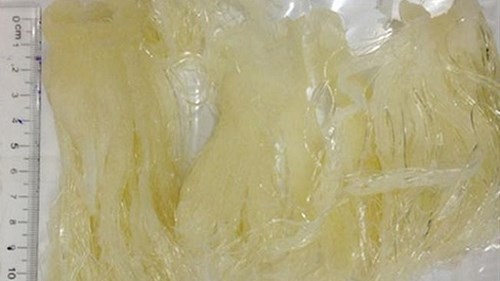 Vi cá mập: Thần dược hay độc dược ?