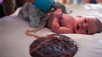Mẹ khiến con chết khi “sinh thuận tự nhiên” có bị truy tố hình sự?