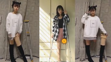 Khâm phục tinh thần sống lạc quan của cô gái bị khuyết một chân