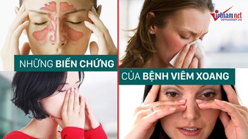 Những biến chứng nguy hiểm của bệnh viêm xoang