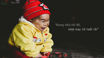 Cô gái 28 tuổi mang hình hài của đứa trẻ lên 3