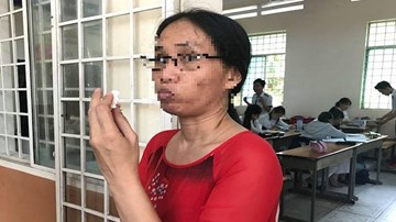 TP HCM xử lý vụ “cô giáo im lặng”