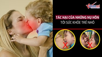 Tác hại của những nụ hôn tới sức khỏe trẻ nhỏ
