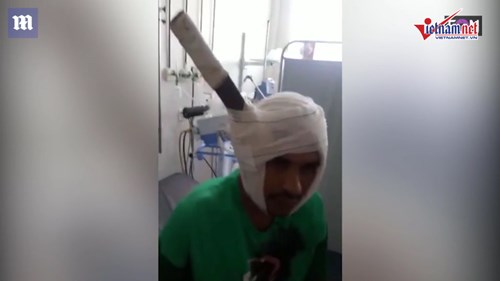 Bị dao cắm vào đầu vẫn tỉnh táo nói chuyện, đi lại bình thường